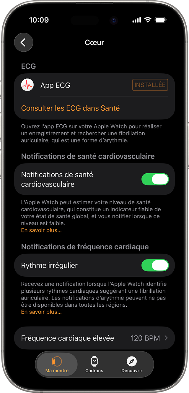 Un iPhone affichant les réglages Santé cardiovasculaire dans l’app Apple Watch.